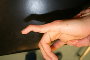 photo montrant un doigt atteint du col de cygne